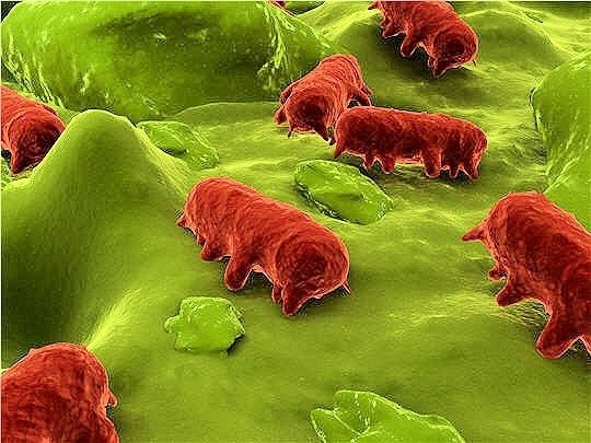 Microbes vus de près